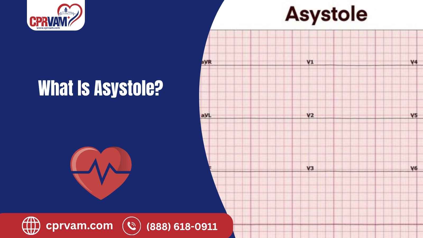 flatline heart rhythm indicating asystole on a cardiac monitor