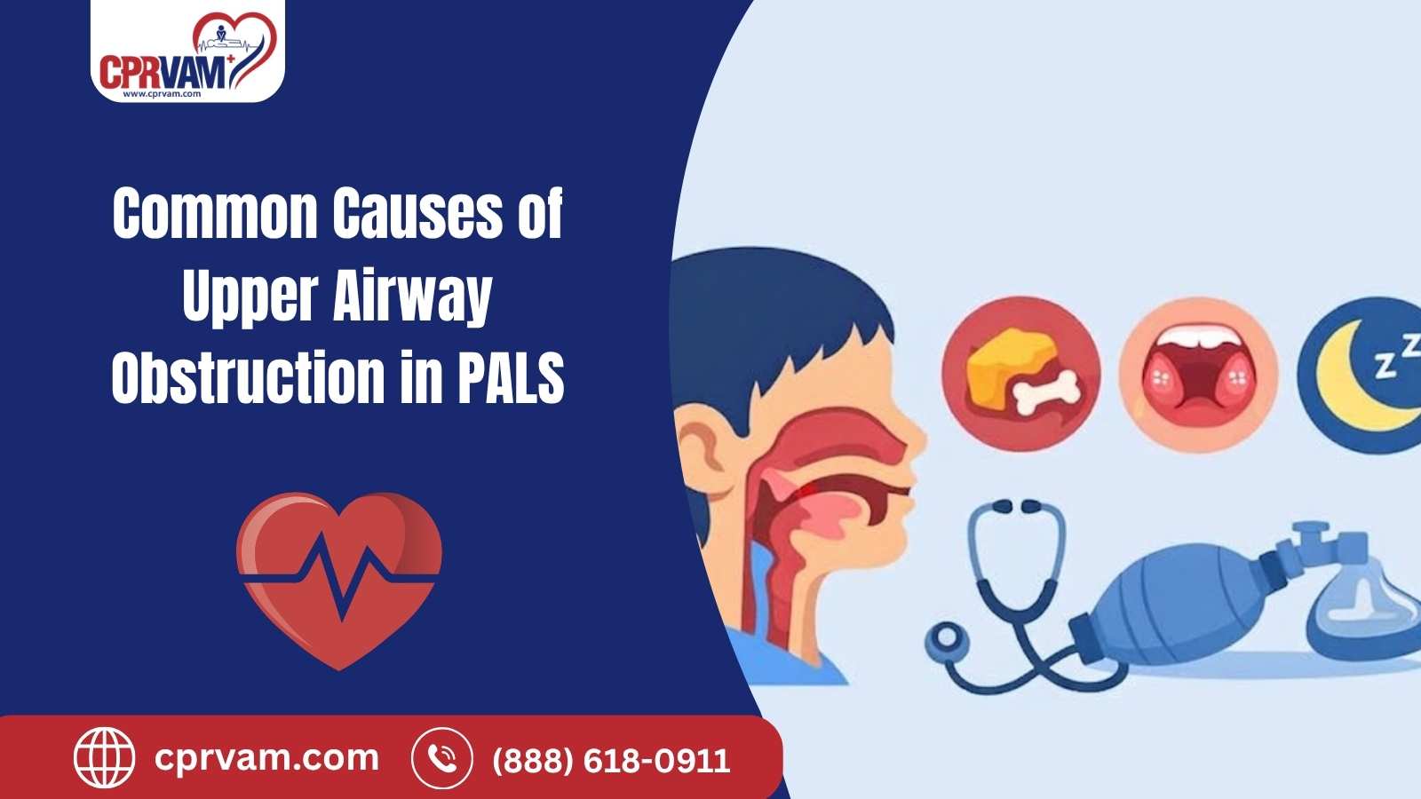 common causes of upper airway obstruction in pediatric pals emergencies