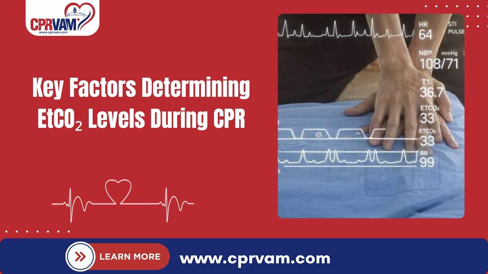 monitoring etco2 levels during cpr on a patient