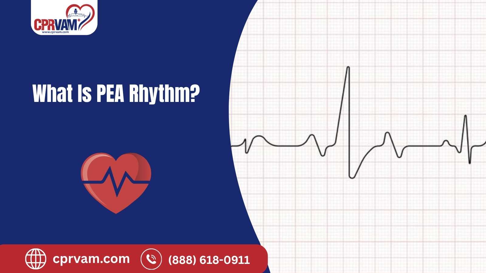 monitoring a patient with pulseless electrical activity (pea) rhythm
