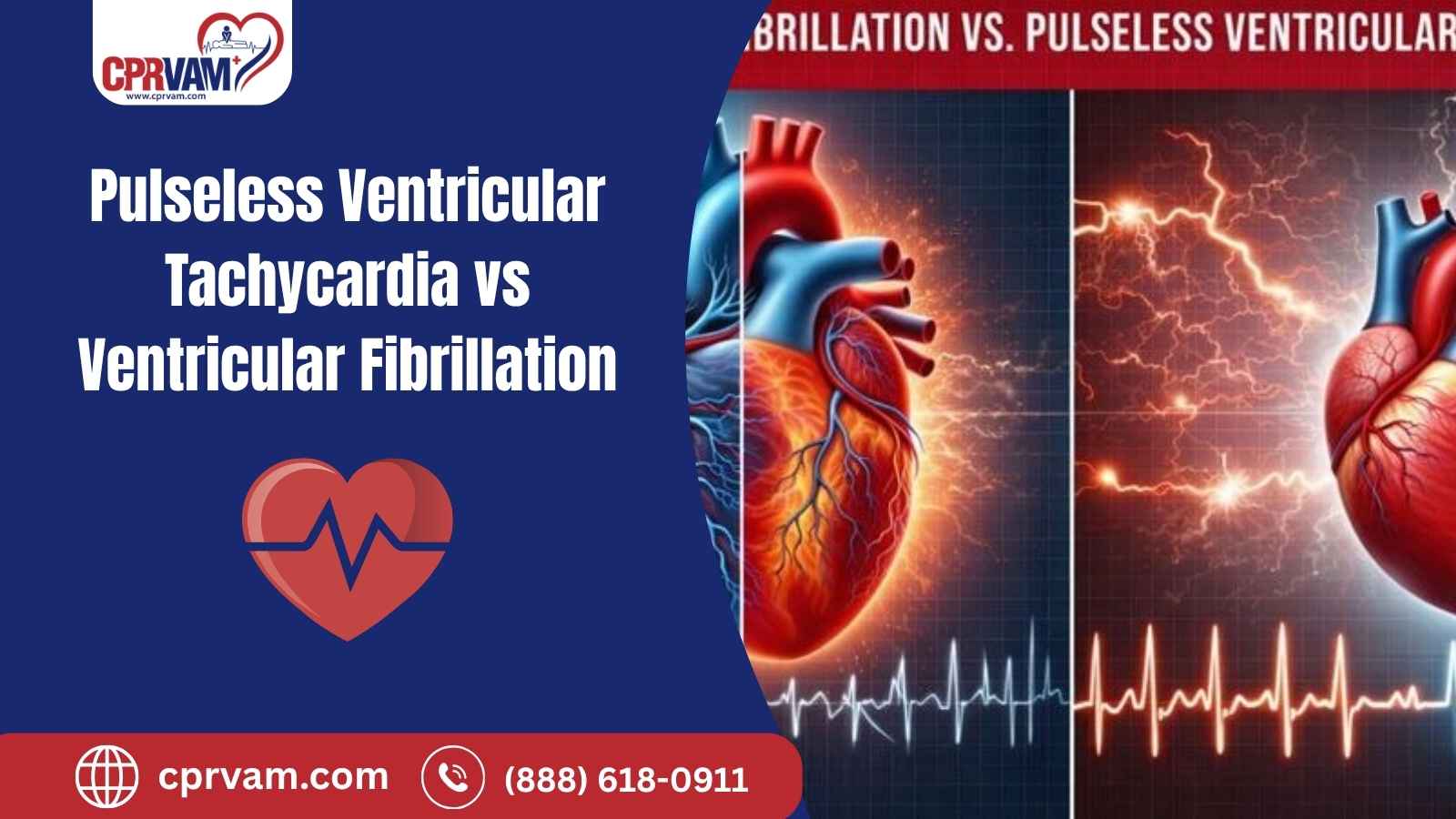 comparison of pulseless ventricular tachycardia and ventricular fibrillation on cardiac monitor
