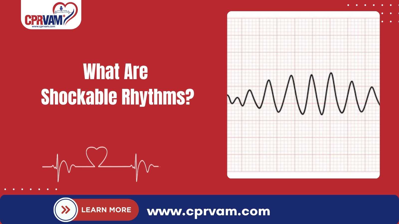 identifying shockable heart rhythms