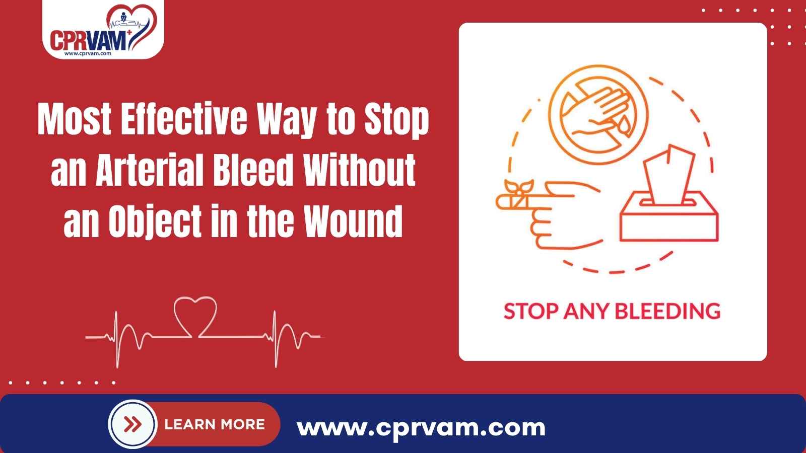 applying direct pressure to stop an arterial bleed without an object in the wound