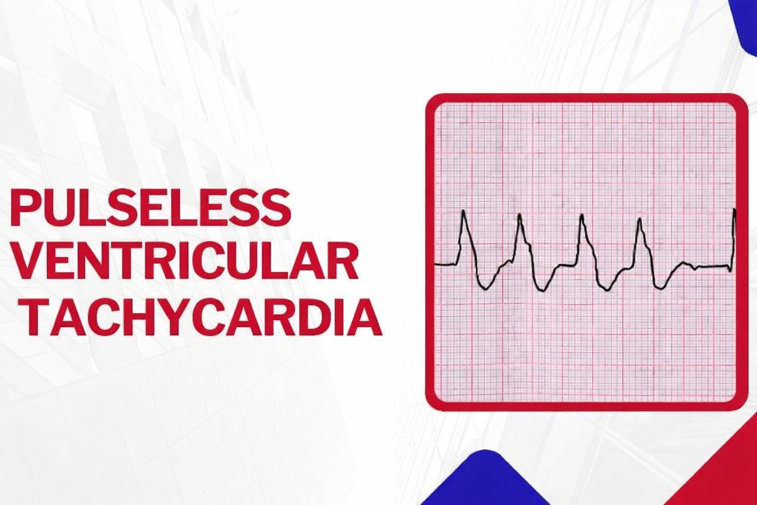 Pulseless Ventricular Tachycardia: Patient Survival Guide