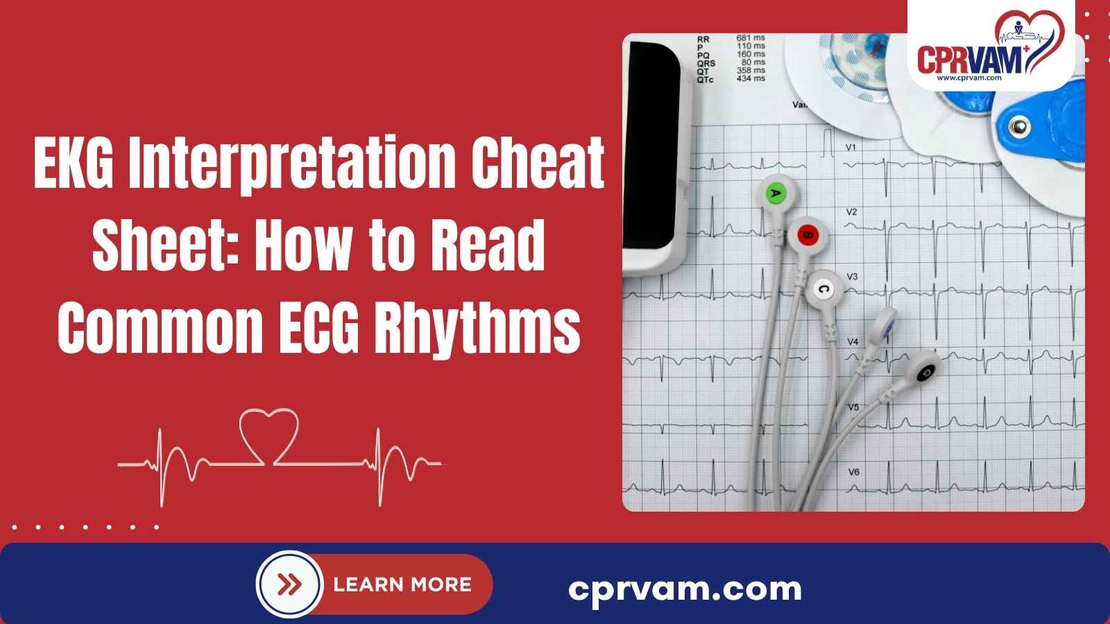 EKG interpretation cheat sheet showing ECG rhythms, normal values, and key interpretation guidelines