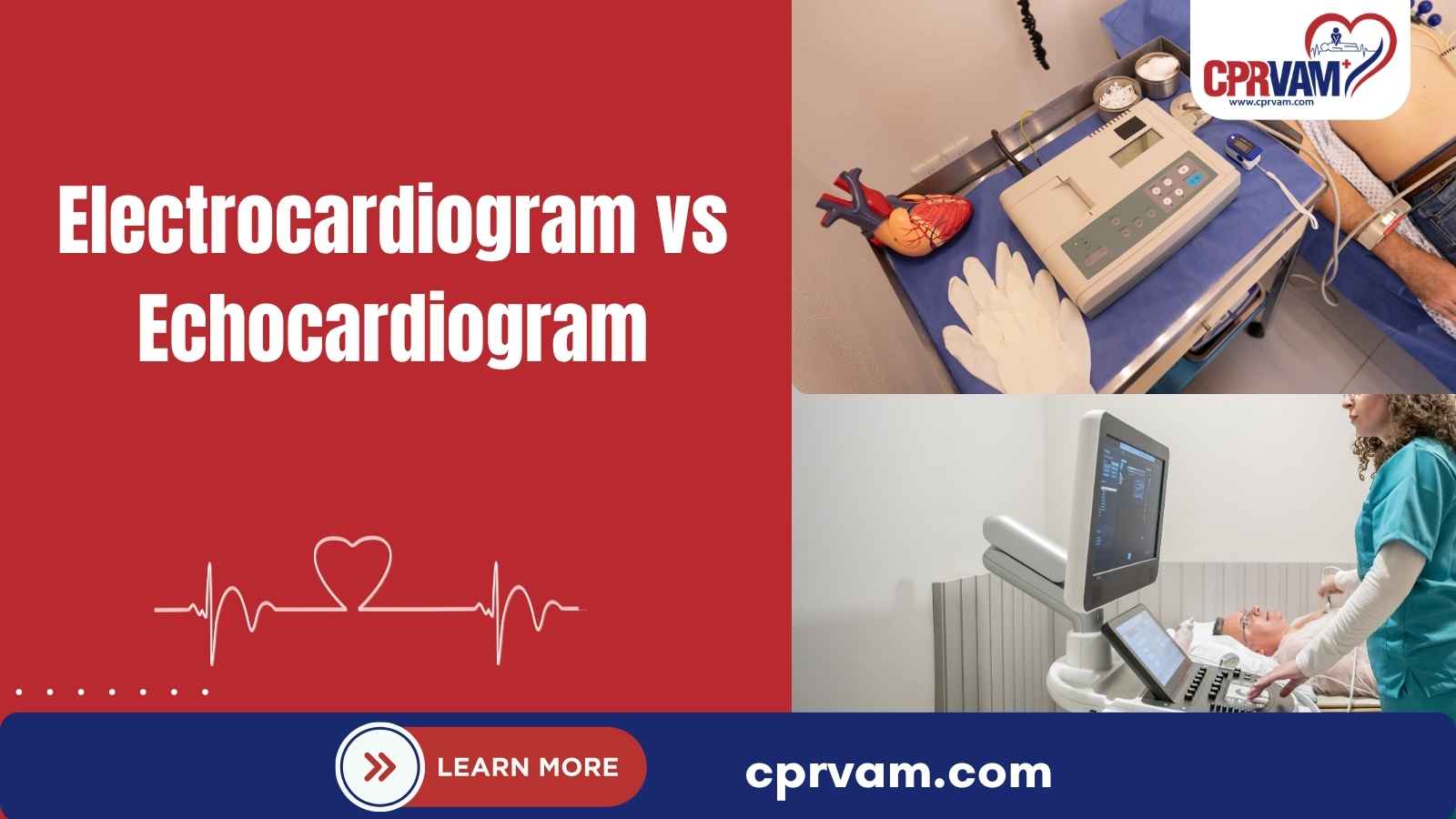 ectrocardiogram vs. echocardiogram showing differences between heart rhythm & structure tests